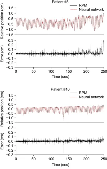Table 2. Errors of marker motion predictions by the neural  network algorithm. Patient no