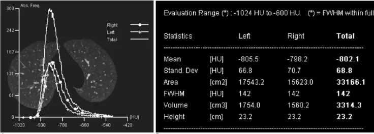 Fig. 1. Demonstration of pulmo-CT results with a histogram (A) and table (B). 