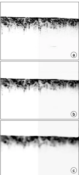 Fig.  4.  The  results  of  the  rotating  kernel  transformation  filter  with  kernels:  (a)  source  image  (b)  11×11,  (c)  20×20  pixels  -  human  cartilage  images.