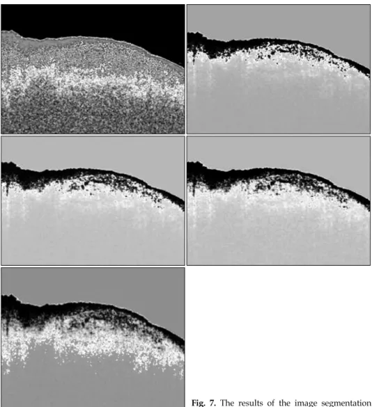 Fig.  7.  The  results  of  the  image  segmentation  for  rabbit  cartilage  OCT  images.