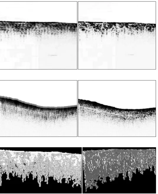 Fig.  8.  The  results  before  and  after  image  matching  for  the  human  cartilage  OCT  image.