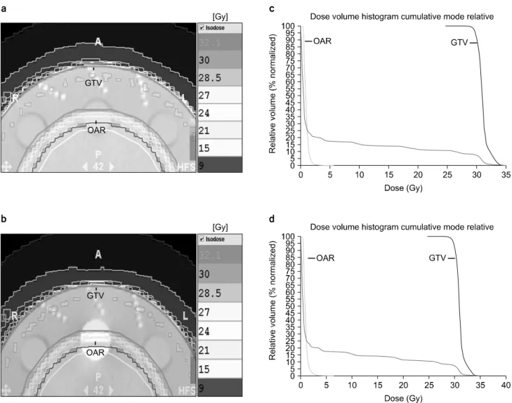 Fig.  4.  Calculated  skin  dose  distribution  from  TPS  using  (a)  a  homogeneous  phantom  and  (b)  an  inhomogeneous  phantom  with  Teflon  for  the  helical  tomotherapy