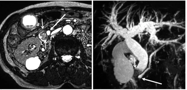 Fig. 2. A 86-year-old man presented with right upper abdominal pain. 