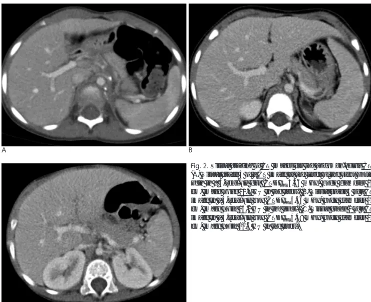 Fig. 2. Visual grading of CT images for the abdomen-pelvis CT.