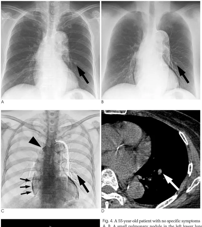 Fig. 4. A 55-year-old patient with no specific symptoms