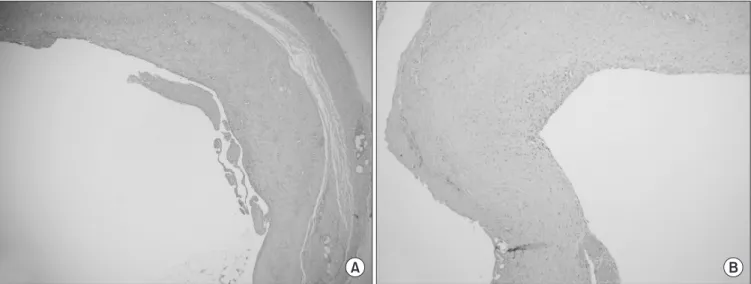 Figure 7. Active dorsal ankle flexion at 30  months.