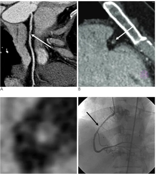 Fig. 3. A 48-year-old female with chest pain. 