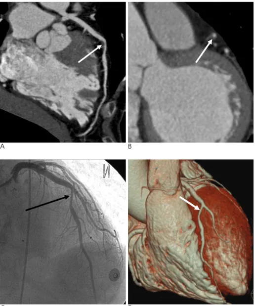 Fig. 5. A 65-year-old female with chest pain.
