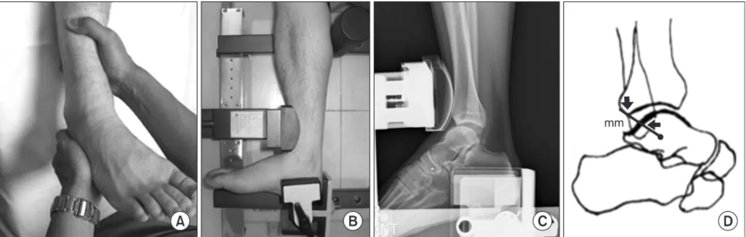 Figure 1. The anterior drawer test. (A) Physical examination. (B) Telos in visual. (C) Telos in radiograph