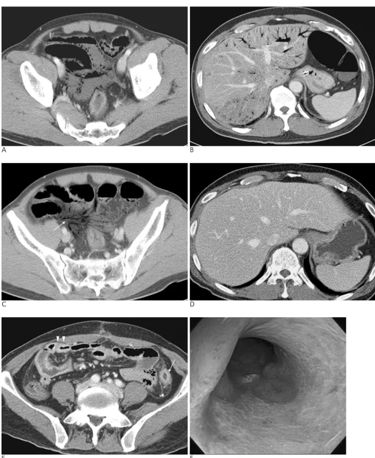 Fig. 2. 55-years-old man with abdominal pain