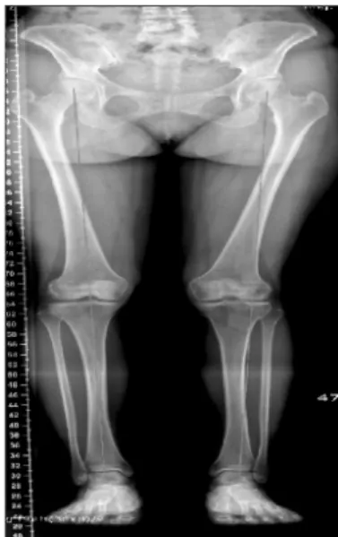 Figure 2. Normal physiologic axes and angles of the lower extremities: 