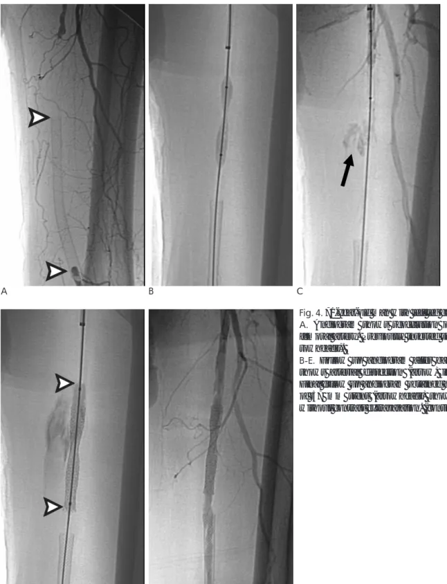 Fig. 4. 71-year-old man with left leg claudication. 