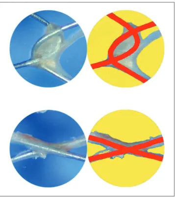 Fig. 2. Two different kinds [Niti-D and Niti-M (Taewoong Medical, Seoul, Korea)] of self-expanding nitinol stents used in this experiment