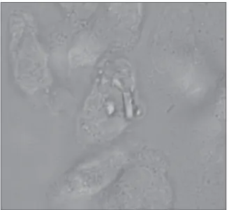 Figure 3. Polarization microscope shows rhomboid and rod shaped  crystals with positive birefringence.