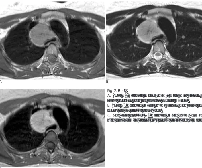 Fig. 2. MRI 
