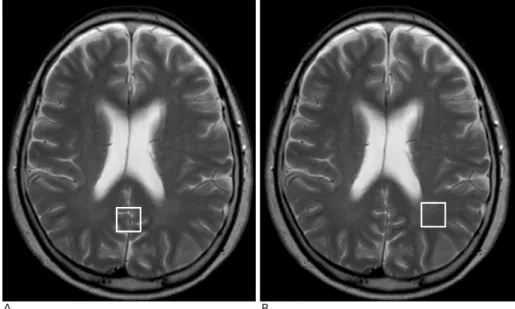 Fig. 1. Axial T2-weighted MR images of a 63-year-old male with CRF. Boxes indicate standardized voxels of  inter-est
