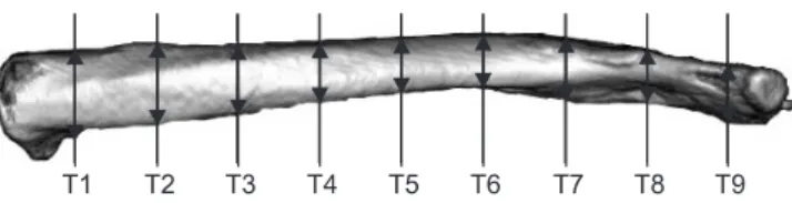 Figure 2. Clavicular width (W; mm) measured at 10% intervals of total  length using Aquilion 64 3-dimensional software.
