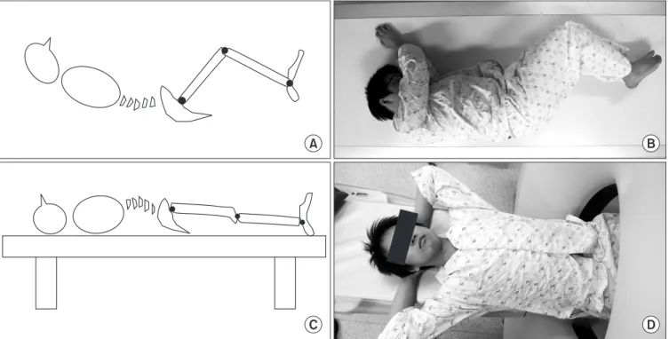 Figure 5. Schematic illustrations and photographs of position when obtaining plain lateral radiography (A, B) and 3D computed tomography (C, D).