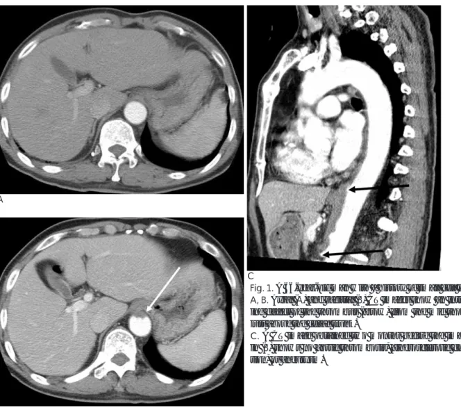 Fig. 1. A 66-year-old man with a history of small cell lung cancer.