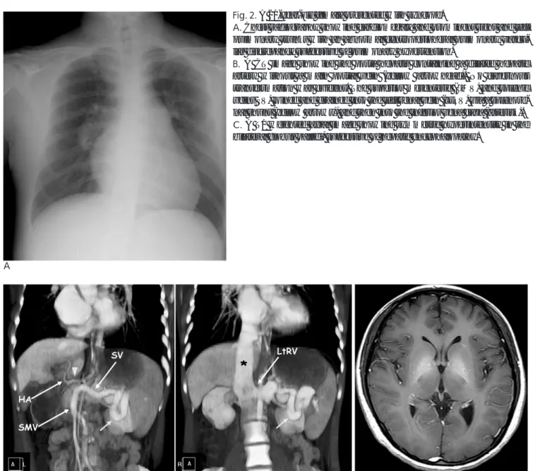 Fig. 2. A 20-year-old female presented with syncope.