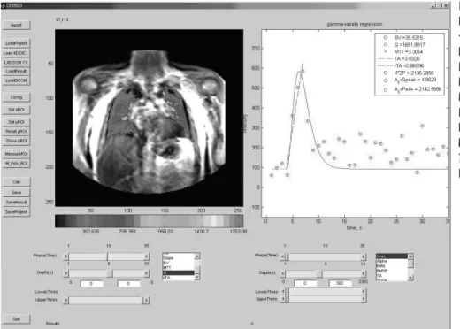Fig. 1. Perfusion Analysis Program based on Matlab 7.0 TM (Mathworks;