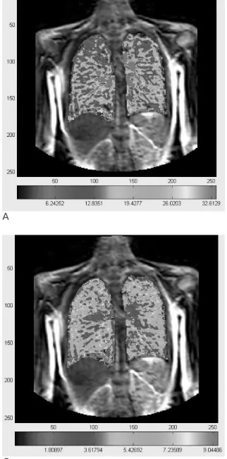 Fig. 3. Examples of Parametric Maps in 30 year old male. 