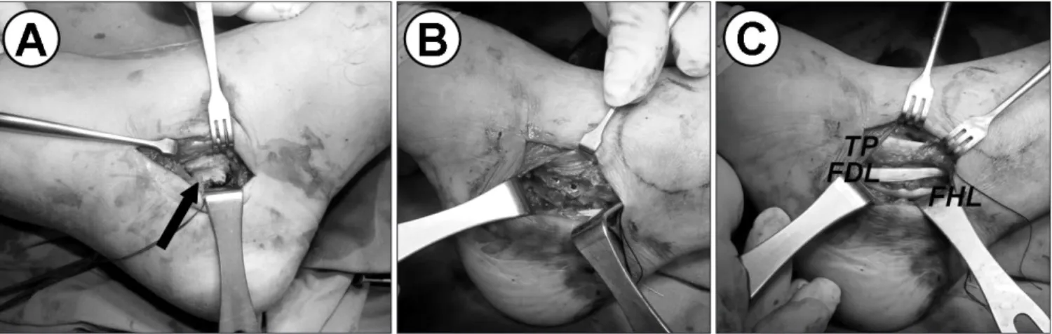 Figure 4. Postoperative radiographs showing the internal fixation with headless compression screws.