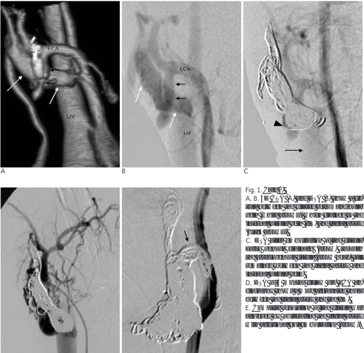 Fig. 1. Case 1. 
