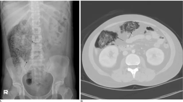 Fig. 1. Case 1: A 18-year old girl with SLE. 