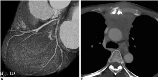 Fig. 4. A 61-year-old woman with con- con-tinuous chest pain during one year. 