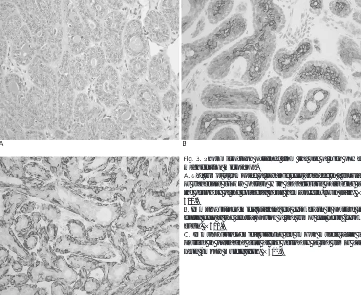Fig. 3. Photomicrograph obtained from the use of high power magnification microscopy.