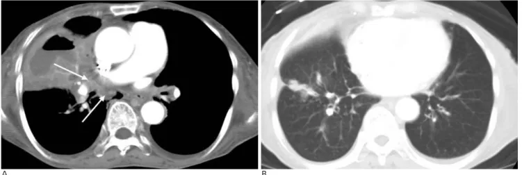 Fig. 1. A 79-year-old woman presented with general weakness. 