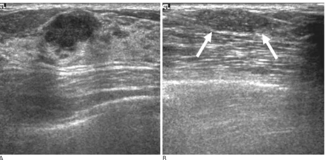Fig. 2. Two malignant cases showing the interobserver variability. 