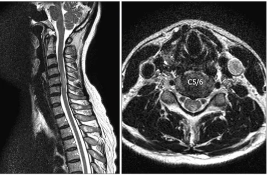 Figure 3. T2W MR image after 1 week.