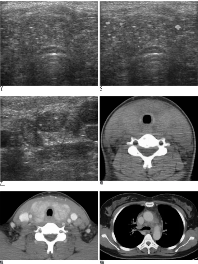 Fig. 1. Radiologic findings on sonography and CT scan