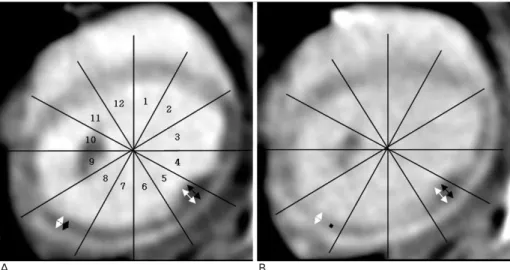 Fig. 1. Twelve equal circumferential segments were analyzed in each  trans-verse section in each rabbit for the evaluation of transmural extent of the myocardial infarction