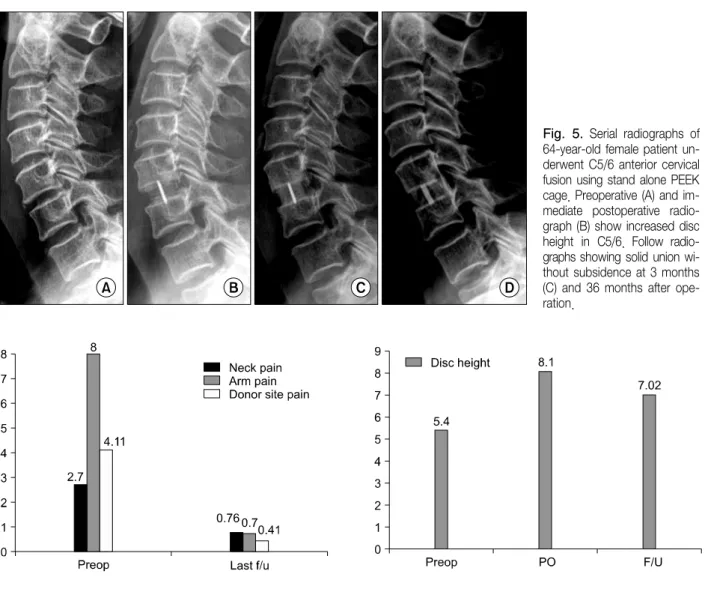 Fig.  6. Graph  showing the clinical outcome analysis  with VAS for  neck,  arm  and  donor  site  pain.