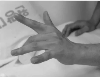 Fig.  2.  Vertical  projection  for  the  3 rd   extensor  digitorum  showed  normal  finding  of  the  continuity  and  echogenicity