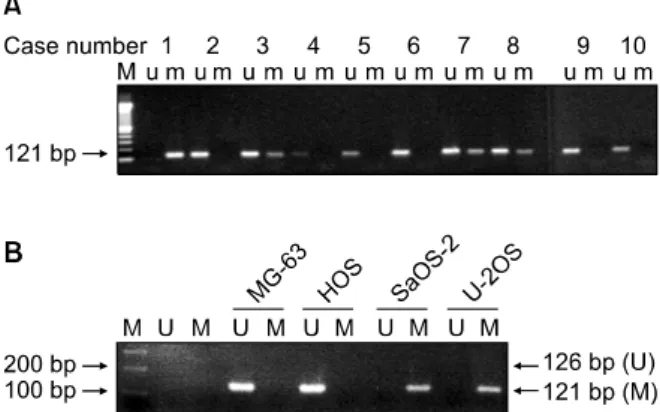 Fig.  3.  Expression  of  RUNX3  in  SaOS-2  cell  line  by  RT-PCR.