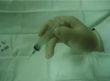 Fig. 1. Syringe holding with right hand. Fig. 2. Appropriate amount of specimen for 3 times smear.