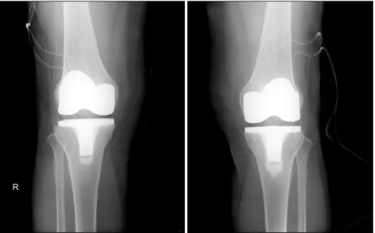 Fig.  3.  Postoperative  films.