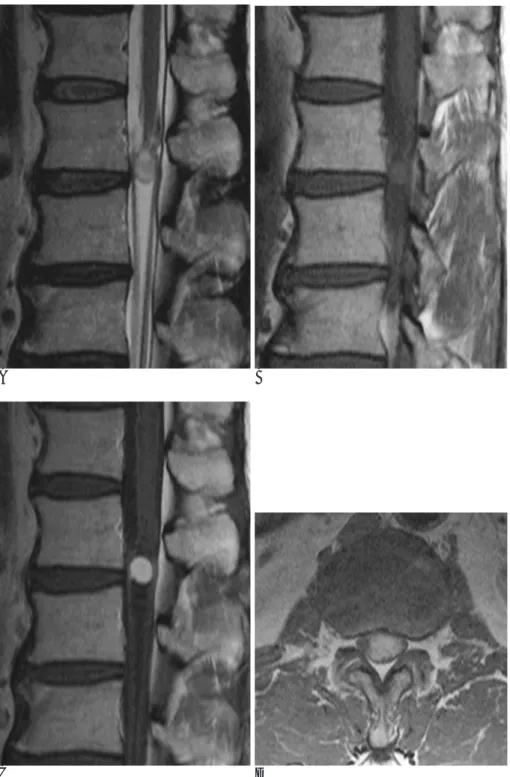 Fig. 1. A 59-year-old man with left thigh to heel pain.