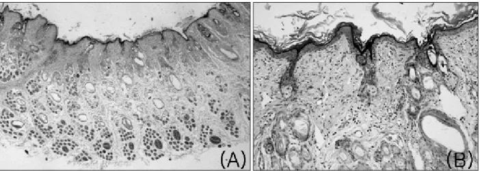 Fig.  7.  Histologic finding in  group  A. (A) Healed tissue  shows  a  moderately  recovered,  relatively  thin  epidermis,  but  a  completely  healed skin  appendage  (×40)