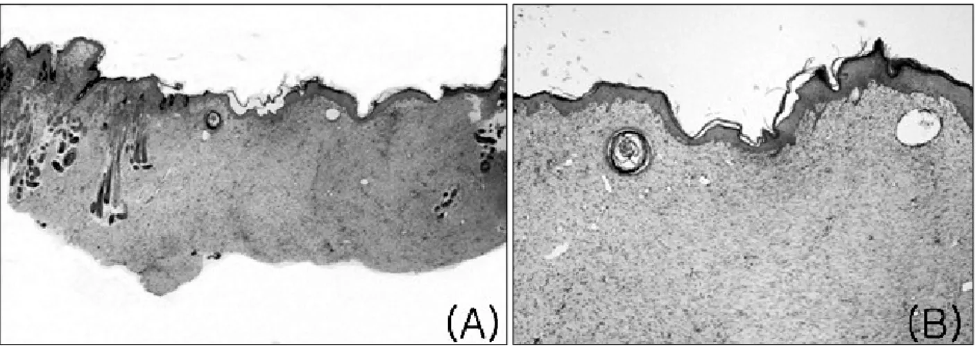 Fig.  10.  Histologic finding in  group  D. (A) Healed  tissue shows an  irregular and flattened  ridge  in the epidermis and the skin  appendage is  mostly  absent  (×40)