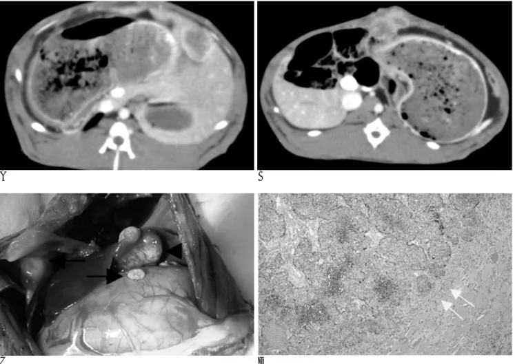 Fig. 3. Early peritoneal seeding due to VX2 tumor leakage.
