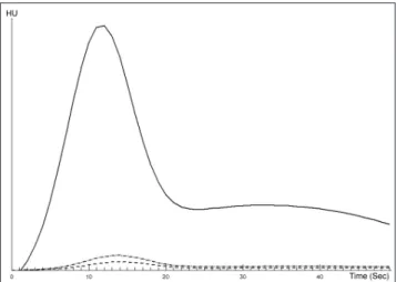 Fig. 2. An example of AIF (Arterial input function) selection and Time-Concentration Curve.