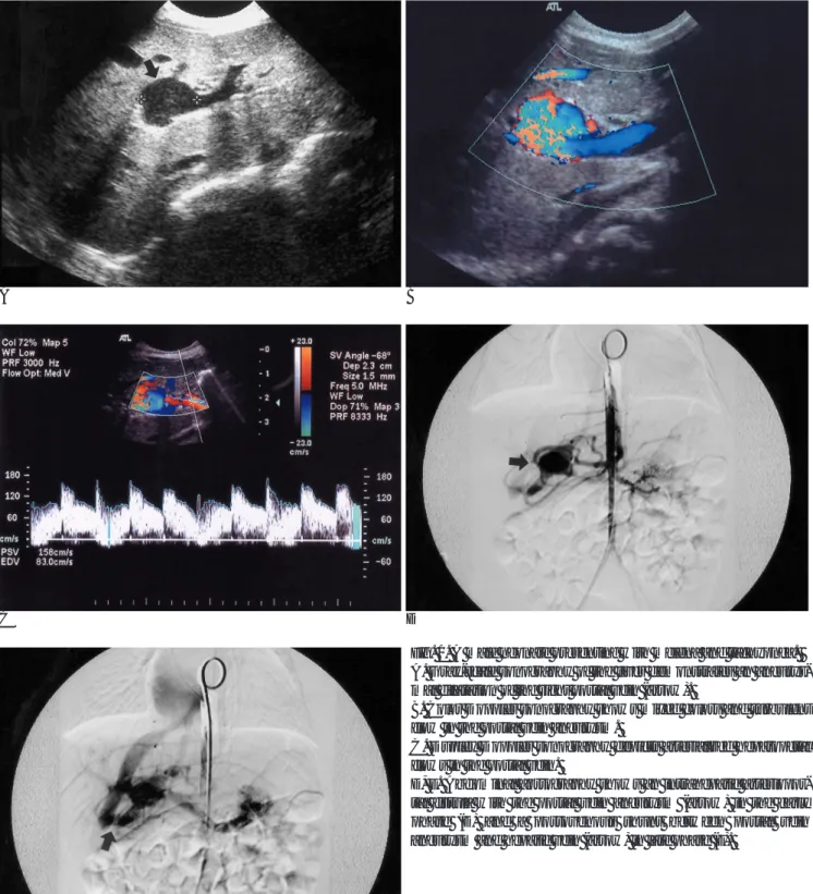 Fig. 1. A male neonate presenting with melena and tachypnea.  