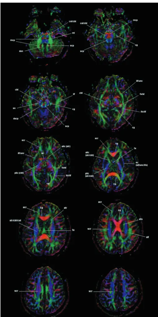 Fig. 5. Diffusion tensor MR images in 12-year-old health boy. Color-coded white matter fiber maps are generated on basis of the three vector elements of the eigenvector v 1 for each voxel