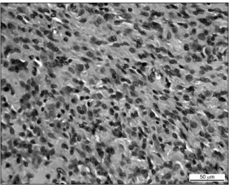 Fig.  1.  A  representative  histological  specimen  is  shown.  Note  the accumulation  of  mononuclear  cells  with  interspersed  giant  cells  and  lipid  laden  macrophages  (H&amp;E  stain,  ×400).