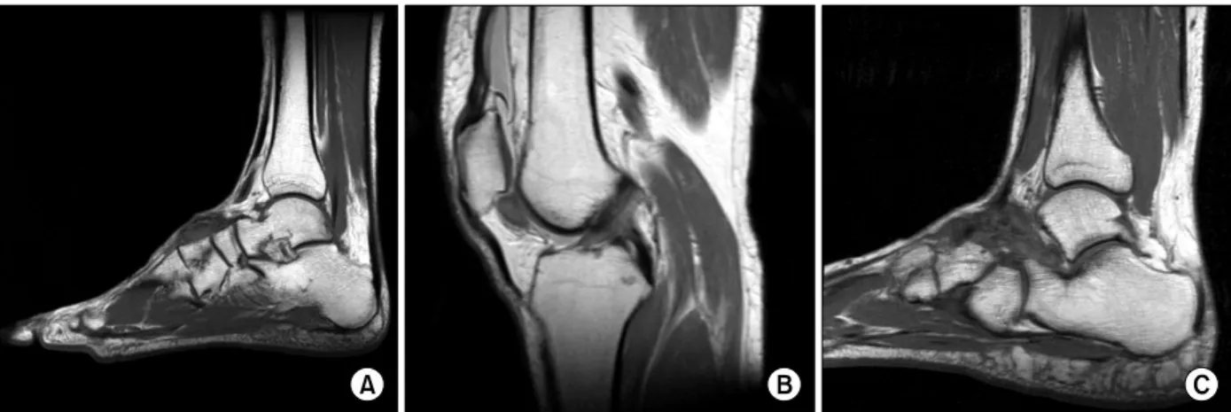 Fig.  4.  Representative  MRI images  of PVNS  according the location  of the  lesion  are  presented